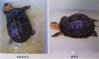 龟龟水肿的症状及应对治疗方法 