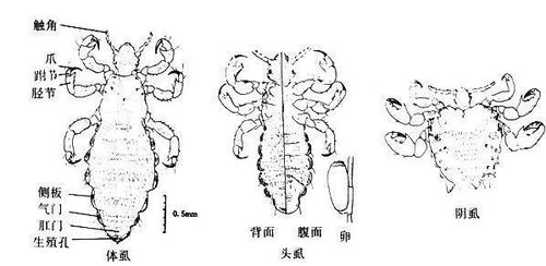 为什么人类会褪去全身体毛,只留下头发 腋毛和隐私部位的毛发