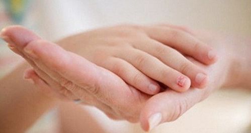 手抖是什么病的预兆 会影响生活吗
