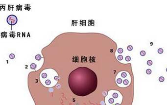 丙肝有什么症状？