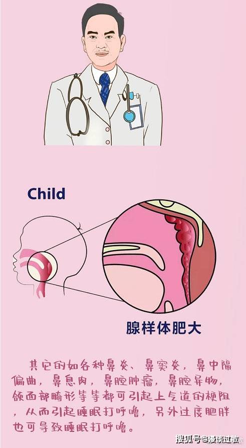 儿童打鼾引发过敏性鼻炎严重并发症的思考