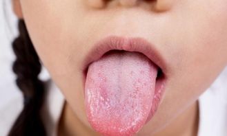 从舌苔上能看出什么身体问题(通过舌苔看身体状况)