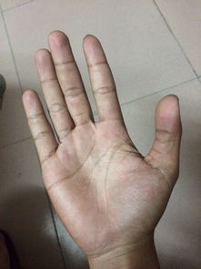 看看我的掌纹命运怎么样 男22岁 两手合起来有六个罗,左手中指和无名指各一个 2个 右手 食指, 