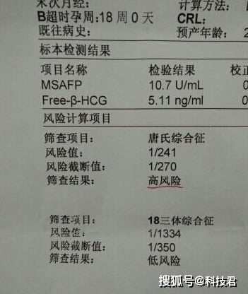 唐氏筛查结果普遍高危,胎儿唐氏率升高了吗 4个分析告诉你答案