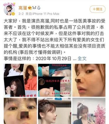 女艺人自爆整容失败鼻尖发黑照吓坏网友 米粒分享网 Mi6fx Com