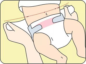 如何给宝宝换纸尿裤 图解纸尿裤正确穿法 