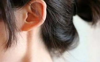 外耳*** 引起外耳道炎常见的病因有哪些？ 