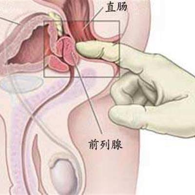 前列腺炎会影响睡眠吗(前列腺炎会影响睡眠吗女性)