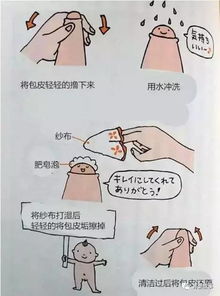 假性包皮要不要割