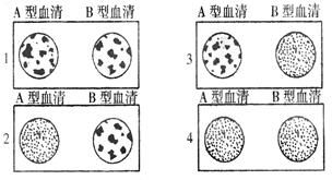 下图为血型检验示意图,1 2 3 4号被检人的血型依次是A. B型 A型 AB型 O型B. A型 B型 O型 AB型C. AB型 O型 A型 B型D. AB型 A型 B型 O型 题目和参考答案 