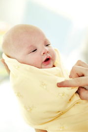 婴幼儿疾病 新生儿有哪些常见疾病