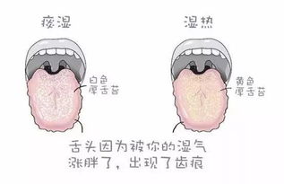 湿气重,毛病多 推荐7味祛湿中药 内含食谱