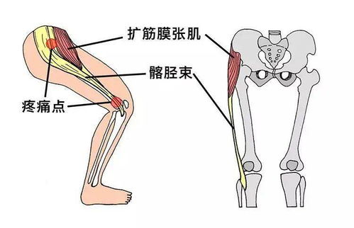 为啥跑完步膝盖痛 跑步的正确姿势,你get了吗