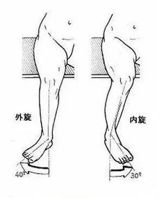 中老年人的膝关节疼痛