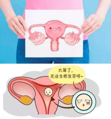 子宫内膜差，试管移植之后能不能成功怀孕？
