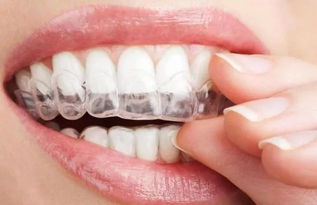 矫正牙齿只能戴牙套 牙齿矫正的误区,你一定要知道 