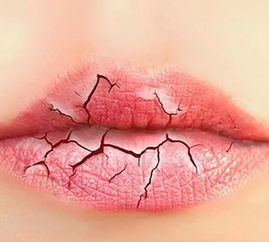 女人舌头尖红是什么原因(舌头尖红有齿痕是什么病)