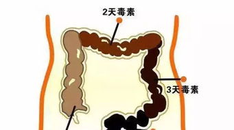 如何通过拔罐缓解便秘