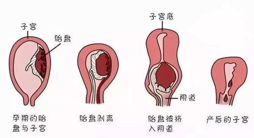 产后要来一个月的 大姨妈 真的吗