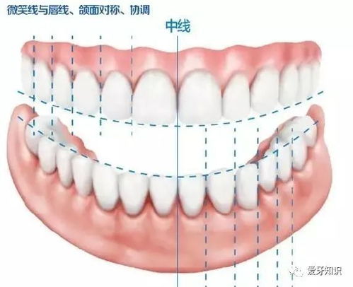 牙齿中线不齐怎么办(矫正牙齿中线不齐要紧吗)