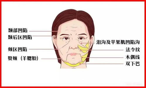 脸上皱纹怎么办 脸上长皱纹怎么办 怎样去皱纹吗