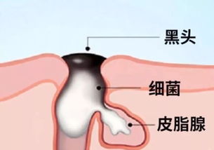 小草莓变煮鸡蛋,跟黑头say拜拜 