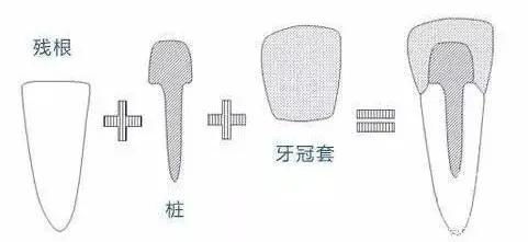 牙齿修复是干啥的 不就是修修补补吗