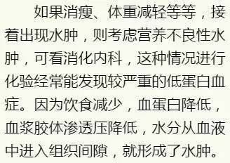 身上不同部位水肿该看哪个科 不同危险信号千万别挂错号 