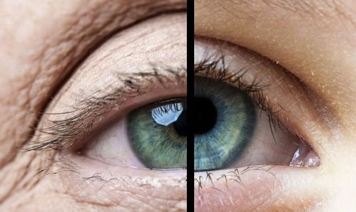 瞳孔放大意味着什么 可能是死亡的标志