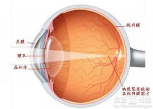 视网膜脱落前的表现是什么