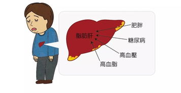 病险肝 该不该买重大疾病保险 