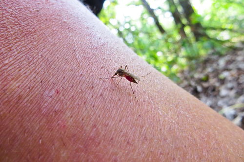 被蚊子叮后皮下有大片淤血是怎么回事 