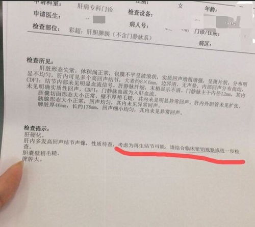 B超报告建议进一步做CT检查,那为什么不直接做CT