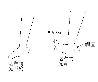 篮球脚踝扭伤后,留下的后遗症,每次剧烈运动后脚后跟会疼痛