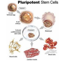 自体外周造血干细胞移植治疗多发性骨髓瘤8例