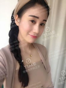 朴素女成时尚潮人 术后五年蜕变秘诀揭秘 