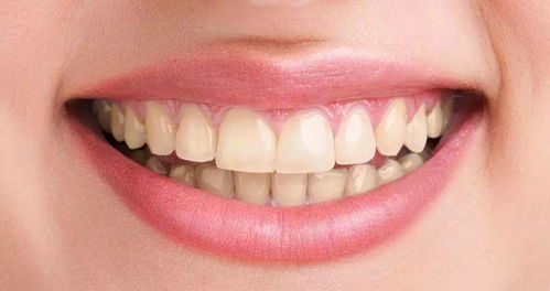 揭秘 为什么每天刷牙,牙齿还会越来越黄呢