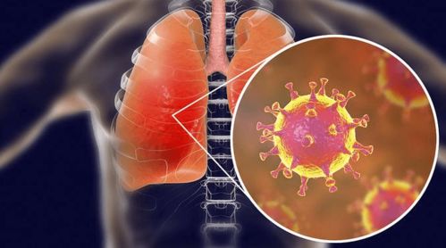 新冠发病症状视频解说（新型冠状病发病视频） 第1张