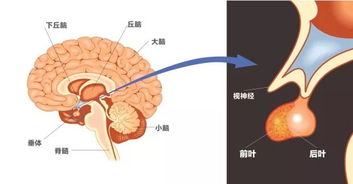 良性脑垂体瘤能活多久 良性脑肿瘤可以活多久？ 