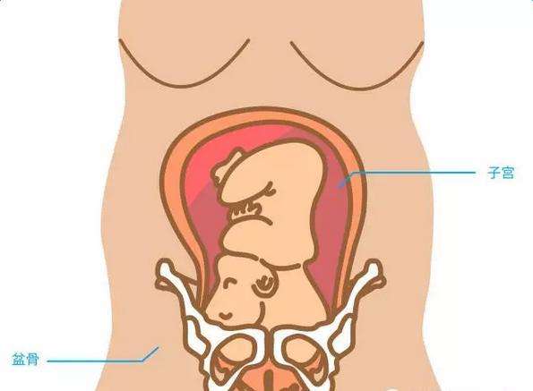 孕妇耻骨疼怎么回事(孕妇耻骨疼是为什么)