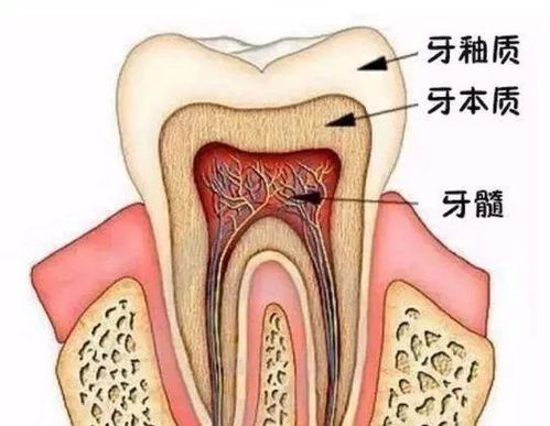 根管治疗后为什么还得戴牙冠