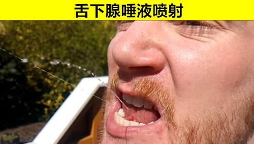 万中无一 的身体 也许大多数人身体上都没有的10个罕见特征