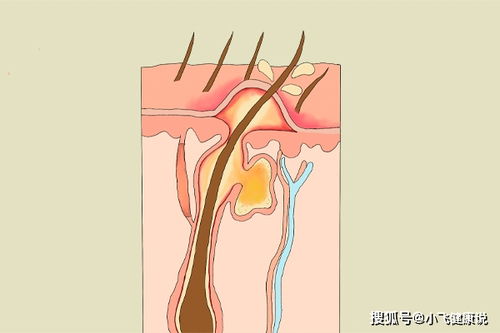 揭秘：女性浓密阴毛下的超强欲望