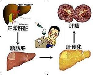 肝脏部好的因素有什么