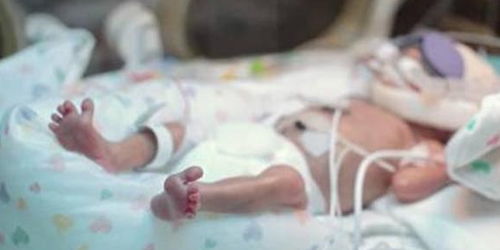 巴掌宝宝 孕24周出生,比早产儿更弱小的超早产儿,能救活吗