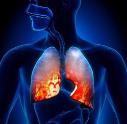 肺纤维化疾病的发病原因有哪些