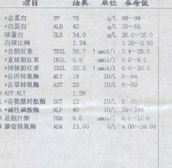 痛风治疗的方法 