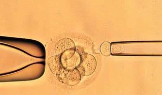 试管胚胎移植之后有哪些常见的问题？