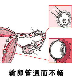 济南女性输卵管通而不畅正常吗[今日公开]济南红绘