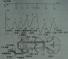诱发电位知识